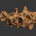 3D Printed Porous Medical Device for Orthopedic Bone Regeneration Surgery