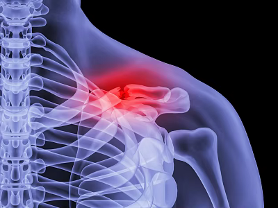 Medical Imaging Device For Shoulder Skeleton Examination With Highlighted Injury Area 3d model