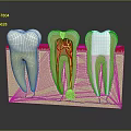 Animated Game Character Dental Anatomy Display With Healthy Decayed And Treated Teeth