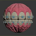 Dental Organ Structure With Pink Gum White Teeth And Metal Brackets