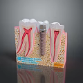 Dental Implant Medical Device With Tooth Structure And Bone Model