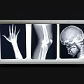 Medical X-ray Viewer Device Displaying Hand Knee And Skull Radiography
