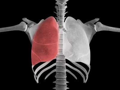 Advanced Medical Device for Lung Imaging Visualizing Chest Skeleton and Pulmonary Abnormalities Scan Results 3d model