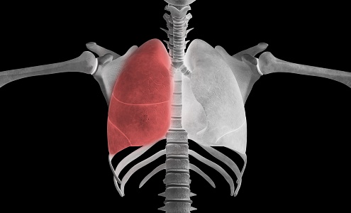 modern lung disease human lung disease 3d model