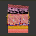 Medical Device 3D Anatomical Model Showing Human Skin Layers And Structures