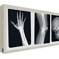 Film viewing light X-ray film viewing light box film reading light box film viewing light box X-ray film film viewing light radiation film image light box medical equipment medical equipment 3d model