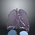 Medical Device 3D Lung Anatomical Model For Healthcare Diagnostic And Training Use