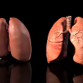 Human Lungs Anatomical Model With Detailed Bronchial Structure And Left Right