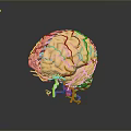 Advanced Medical Device for Brain Vessel Visualization Using 3D Modeling Technology