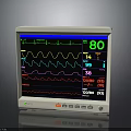 TRUMED EX30 Medical Electronic Monitor with ECG Waveform and Vital Signs Data