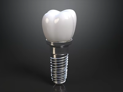 White Dental Implant With Natural Looking Tooth And Silver Screw Base On Black Background 3d model
