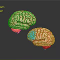 3D Anatomical Brain Model Medical Device with Detailed Structure for Medical Education and Research