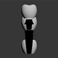 Dental Implant Medical Devices With Three White Crowns And Metal Screws