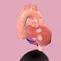 Medical Device Anatomical Heart Model for 3D Visualization in Medical Education