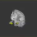 Transparent Brain Model with Hair like Structures and Purple Yellow Components 3d model