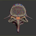 Medical Device Visualizing 3D Rendered Cervical Spine Anatomical Vascular and Bone Structures 3d model