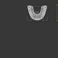 Dental Upper Jaw Denture Model with Red Gum Base and White Teeth