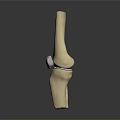 Knee Joint Medical Device 3D Model for Orthopedic Implant and Surgical Planning