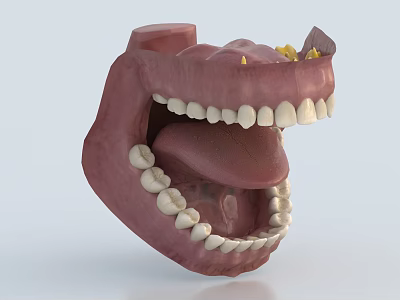 3D Dental Oral Model Medical Device with Teeth and Gums Structure 3d model