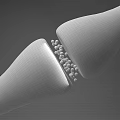 Innovative Medical Device With Tubular Structure And Micro Particles For Cellular Treatment