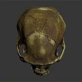 Medical Device Skull Model For Anatomical Teaching And Orthopedic Training