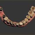 Dental Implant Modern Teeth 3d model