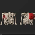 Chest Organs Anatomical Model With Thoracic Skeleton And Red Muscle Structure