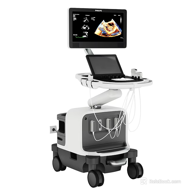 Advanced Mobile Medical Ultrasound System With Monitor Laptop Trolley And Cables 3d model 