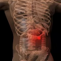 Medical Imaging Device for Human Anatomy Visualization with 3D Body Scan and Highlighted Internal Organs