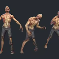 Loss of autopsy infection 3d model