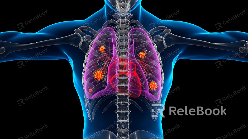 Modern pulmonary infection Pulmonary infection Human body model