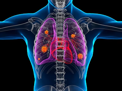 Medical Imaging Device For Lung Visualization With 3D Transparent Thorax And Virus Particles 3d model
