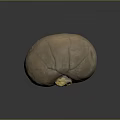 Medical Device Anatomical Organ Model with Yellow Pathological Lesion for Training