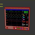 TRUMED EX30 Medical Electronic Monitor with ECG Waveform and Vital Signs Data