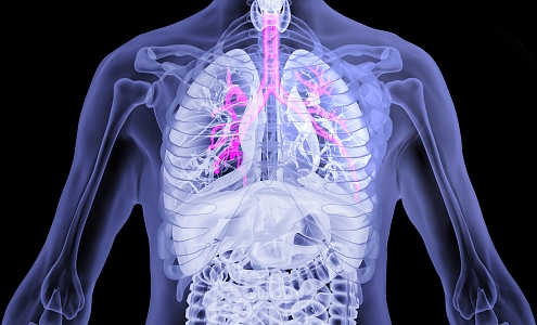 Modern bronchitis Human bronchitis 3d model