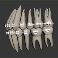 Dental Teeth Model Displaying Clear Orthodontic Braces For Teeth Alignment 3d model