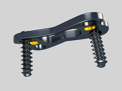 Medical Orthopedic Bone Plate With Surgical Screws Yellow Indicators And Metal Construction 3d model