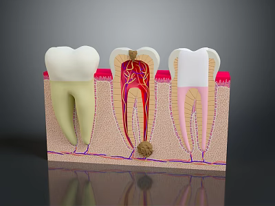 Animated Game Character Dental Anatomy Display With Healthy Decayed And Treated Teeth 3d model