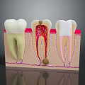 Animated Game Character Dental Anatomy Display With Healthy Decayed And Treated Teeth