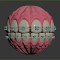 Dental Organ Structure With Pink Gum White Teeth And Metal Brackets