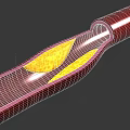 Man Examining Blood Vessel Interior With Yellow Plaque Buildup Structure 3d model