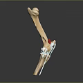 Detailed 3D Model of Human Leg Bone with Red Markers and White Fixation Device