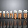 Tooth Models In Different Stages Showing Structure With Roots And Crowns On Gray Background 3d model