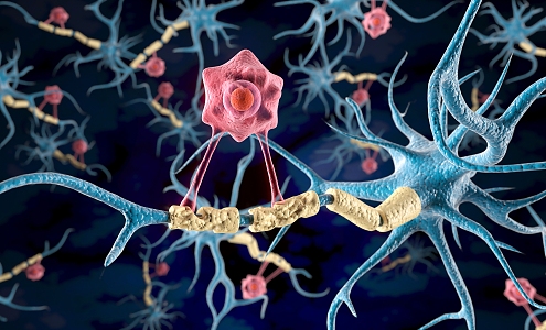 modern nervous system disease 3d model