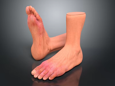 Man With Amputated Ankle Prosthetic Foot And Red Skin Areas On Feet 3d model