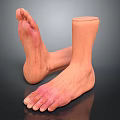 Man With Amputated Ankle Prosthetic Foot And Red Skin Areas On Feet