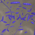 Rod Shaped Blue Bacteria Microscopic View With Long Filaments And Cells