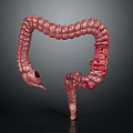 3D Medical Illustration of Human Intestinal Anatomy Model with Red Inflamed Areas