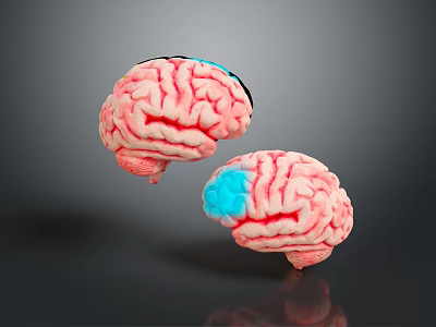 3D Anatomical Brain Model Medical Device with Detailed Structure for Medical Education and Research 3d model