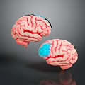 3D Anatomical Brain Model Medical Device with Detailed Structure for Medical Education and Research